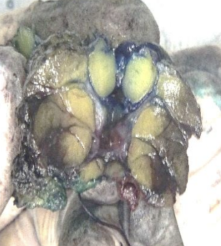Description of the image